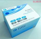 Human EphB6/Eph Receptor B6 ELISA Kit